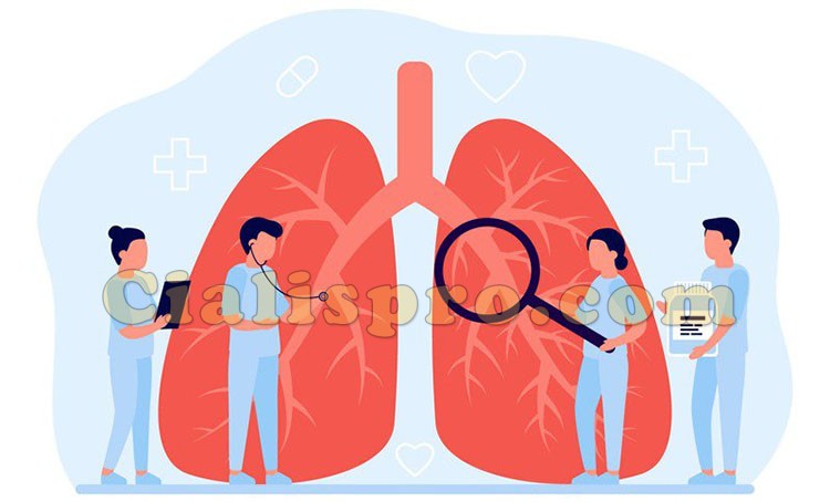 治療肺動脈高壓的方法